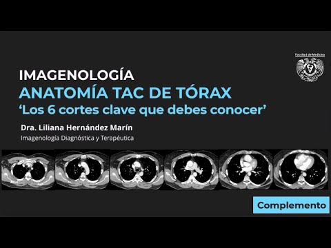 Vídeo: Impacto Clínico De La Variabilidad En La Radiología De La TC Y Sugerencias Para La Selección Adecuada De Características: Un Enfoque En El Cáncer De Pulmón