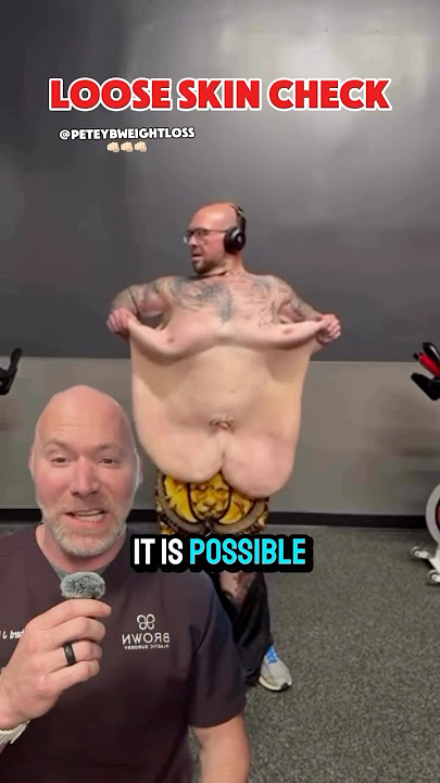 Download lagu Loose Skin After Massive Weight Loss