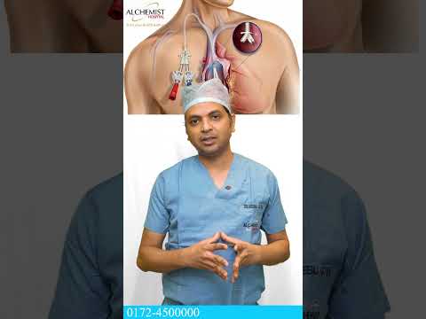 Kidney Transplant over Dialysis. Alchemist Hospital Panchkula. #kidney #kidneyhealth #kidneydisease