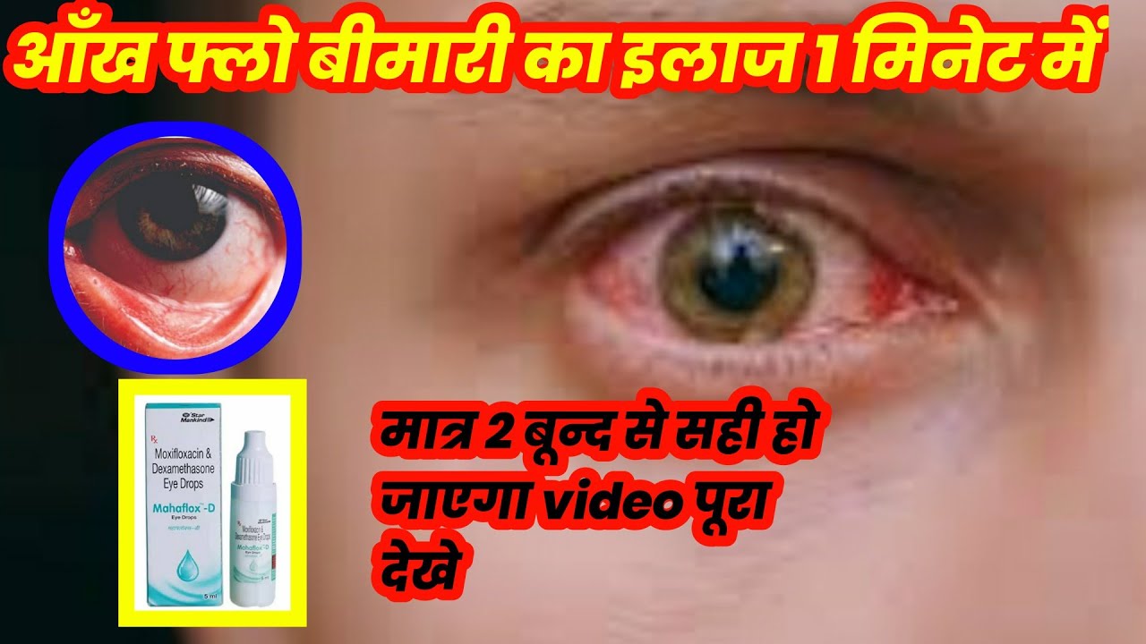 Eye Flow Eye Flow आँख में जलन सूजन दर्द ।। मात्र 2 बून्द से गारंटी के साथ आराम ...