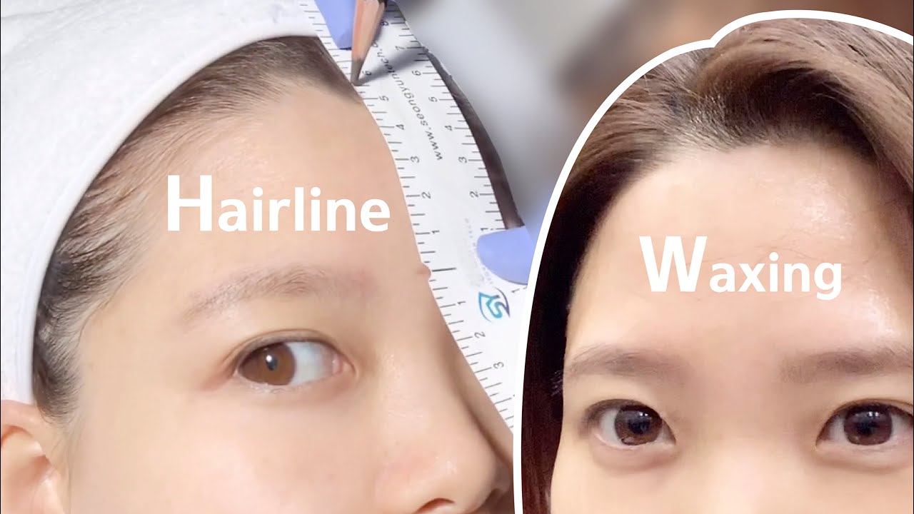 원숭이 이마, 생애 첫 M자 이마 탈출기 헤어라인 왁싱 했어요. 예쁜 이마로 자신감 뿜뿜 Hairline Waxing in korea 뷰티일상 브이로그