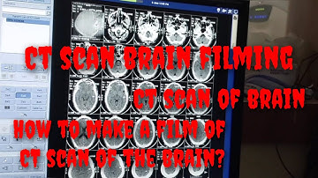 CT scan of brain filming / plating || CT scan of brain scanning || CT scan film || Brain CT scan