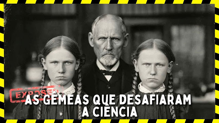 (1834, Kentucky) O Mistério Macabro das Gêmeas Que Nem Mesmo a Ciência Consegue Explicar