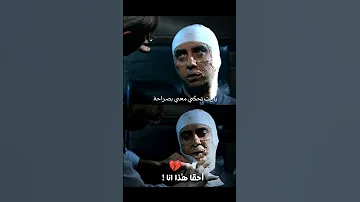 لحظة انهيار مراد علمدار حين رأى وجهه في المرأة 
