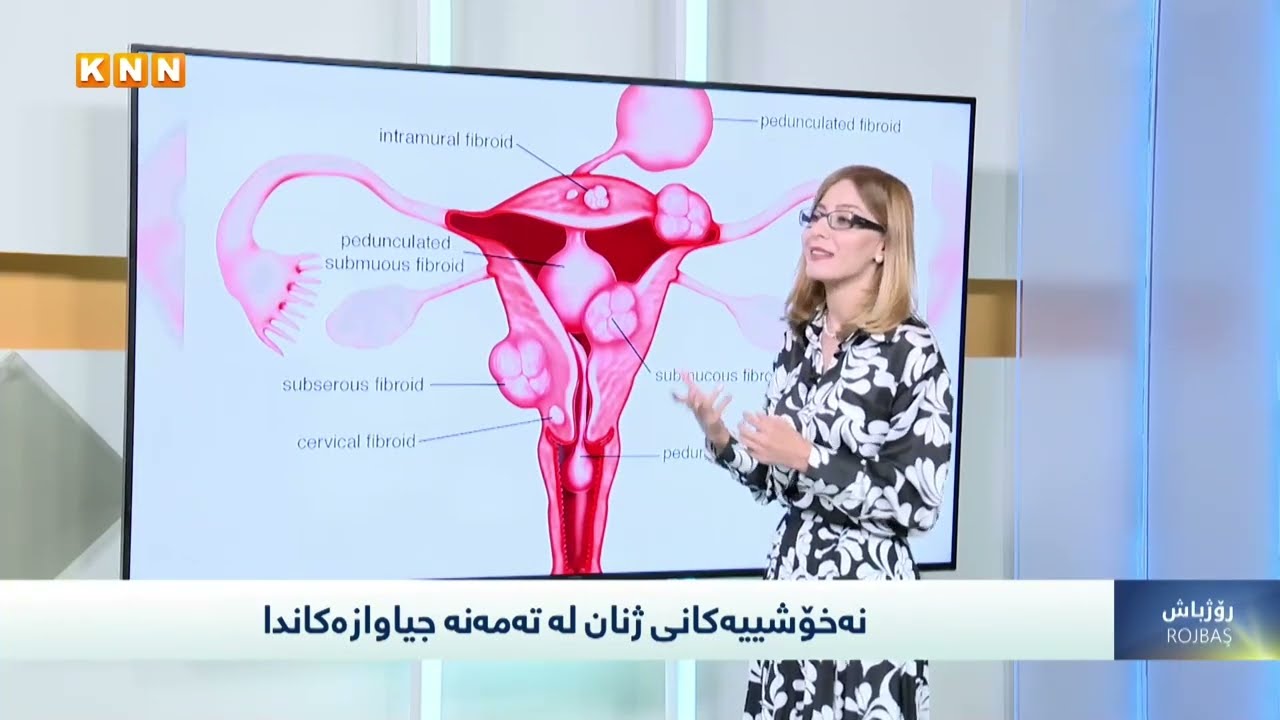 جۆرەکانی گرێی منداڵدان کامانەن؟