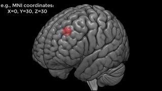 Introduction to Region of Interest (ROI) Analysis in fMRI