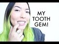 My Tooth Gem | soothingsista