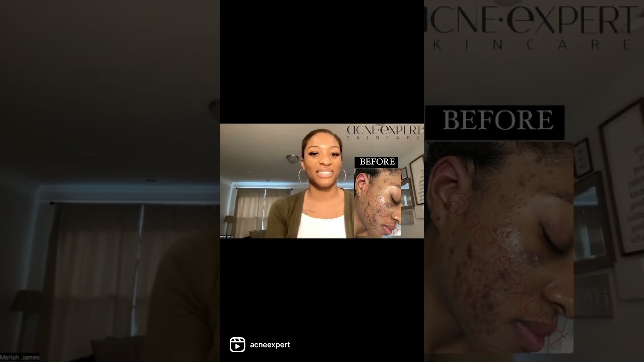 BECAUSE IT WORKS ✔️ 