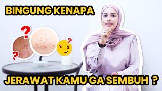 CONFUSED? WHY YOUR ACNE IS NOT HEALING?