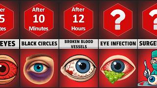 Timeline: What Happens If You Rub Your Eyes Nonstop ? Net Worth
