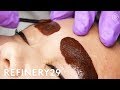 Why I Got My Eyebrows Tattooed Again | Beauty With Mi | Refinery29