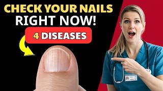 Doctor Explains: 4 Hidden Diseases Your NAILS Can Reveal After 60