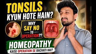 🩺 Bar Bar Tonsils? Operation Ya Homeopathy? Complete Guide