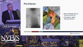 Alternative Access for Complex Aortic Interventions   Darren B  Schneider    Aortic Session