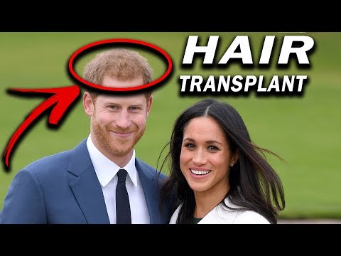 Video: Il principe Harry avvistato alla clinica per il trapianto di capelli