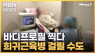 MZ세대 바디프로필 열풍에 무리한 운동…'횡문근융해증' 걸릴라  [MBN 뉴스7]