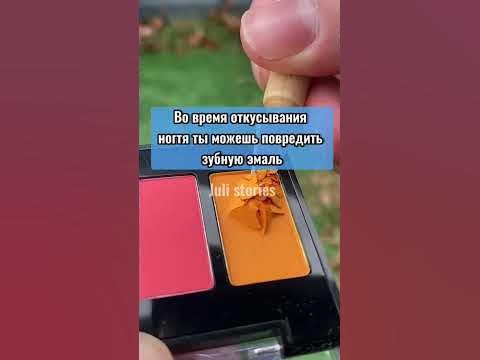 Что будет, если постоянно грызть ногти #shorts - YouTube