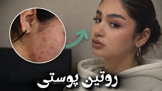 واقعیترین تجربه من برای صاف شدن پوست