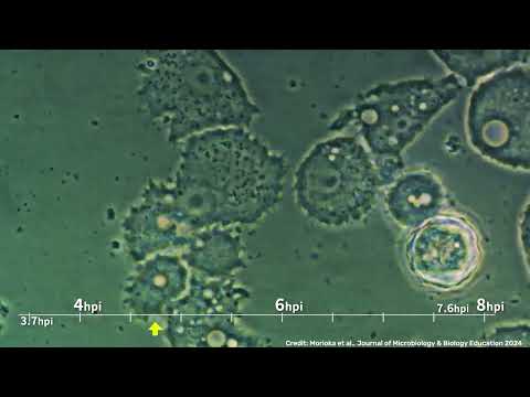 Giant Mimivirus Infecting Cells