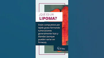 ¿Cuál es el tipo más común de lipoma?