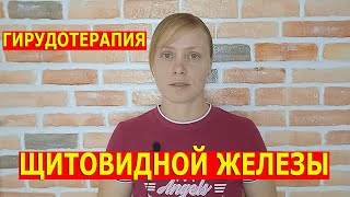 ГИРУДОТЕРАПИЯ  / ПИЯВКИ / ЛЕЧЕНИЕ ЩИТОВИДНОЙ ЖЕЛЕЗЫ