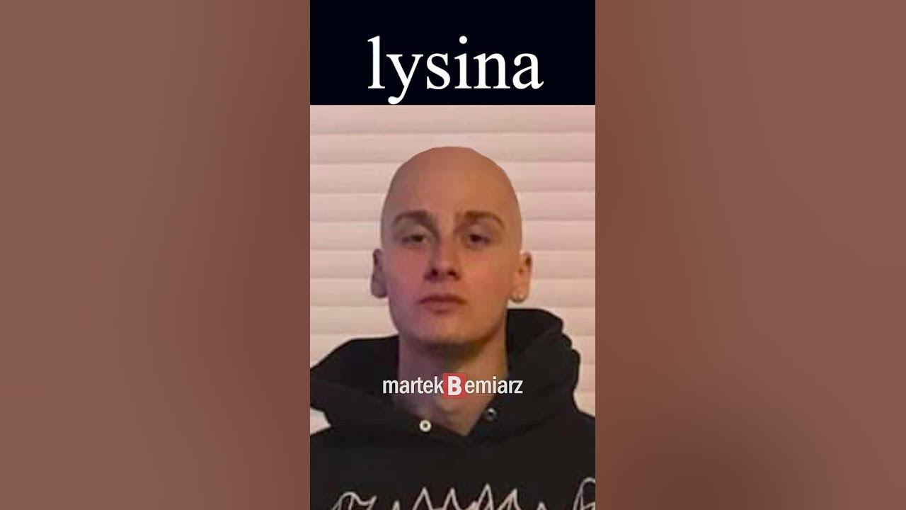 łysina - YouTube