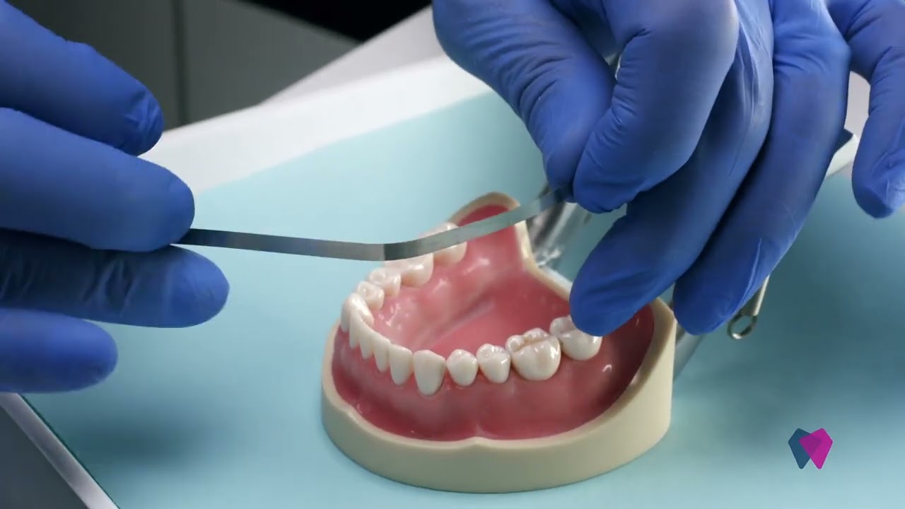 Diamond IPR Strips: The Underrated MVP of Invisalign & Overhang Cleanups