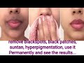 Hyperpigmentation, suntan, blackspots darkness around lips and mouth, couses and treatment