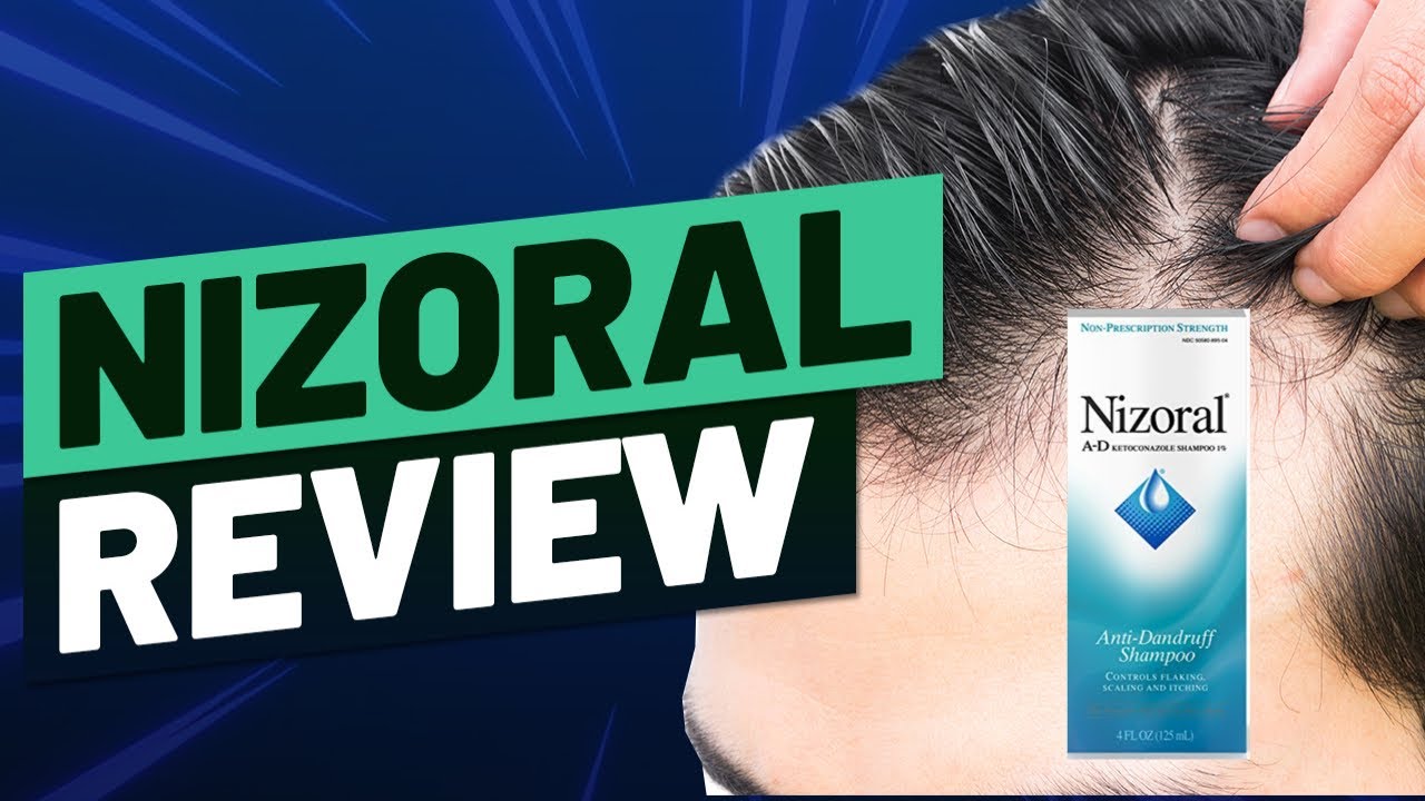 Nizoral Shampoo Hair 101: Does It Work? - YouTube
