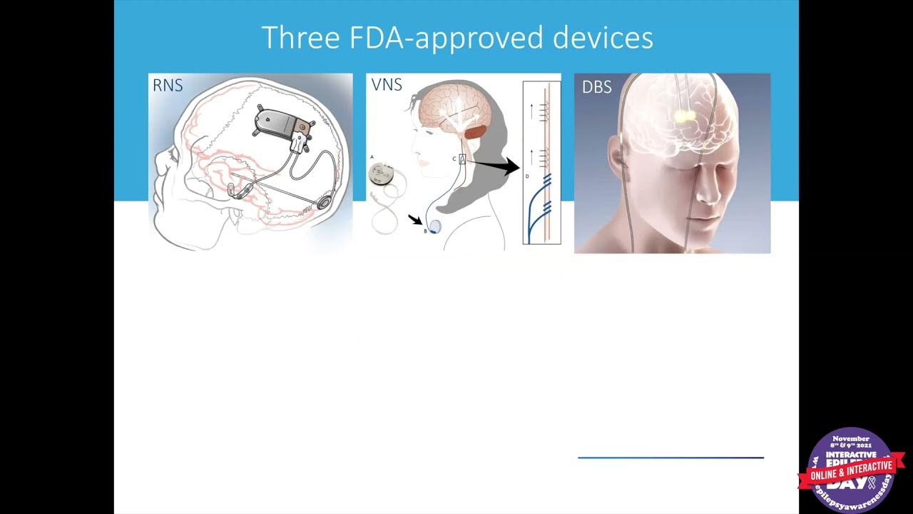 Epilepsy Awareness Day at DL 2021 Vikram Rao, MD PhD