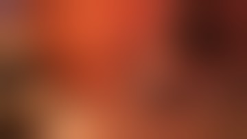 Intracorneal Ring Segment removal (INTACS)