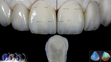 The Staining technique in imitating natural teeth, the IPS Ivocolor system explained