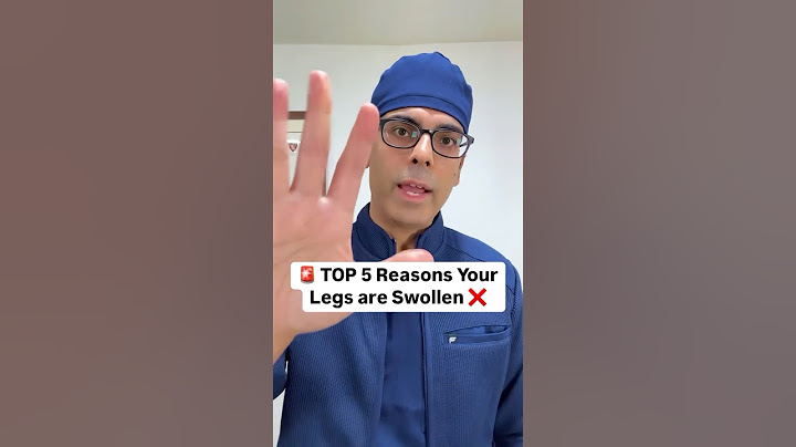 Top 5 Reasons Your Legs are Swollen ❌ Doctor Sethi
