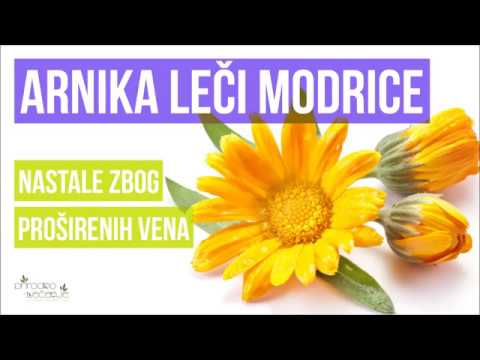 Arnika za lečenje modrica kod proširenih vena