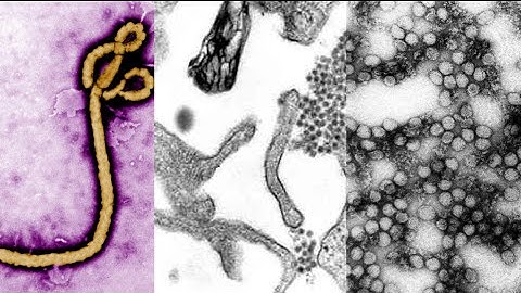 A simple, cheap test for ebola, dengue and yellow fever.