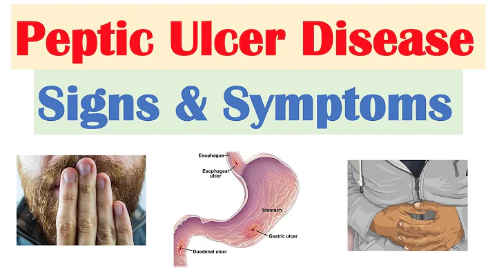 Peptic Ulcer Disease Signs & Symptoms | Gastric vs. Duodenal Ulcers - DayDayNews