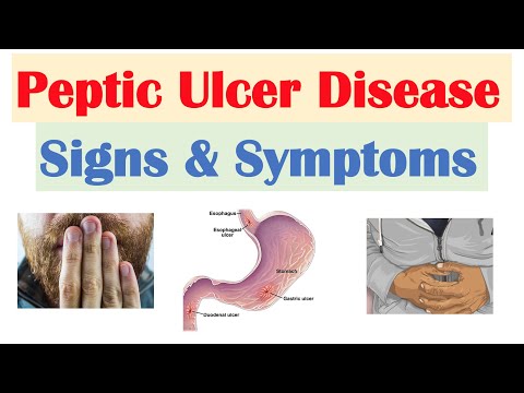 Peptic Ulcer Disease Signs & Symptoms | Gastric vs. Duodenal Ulcers