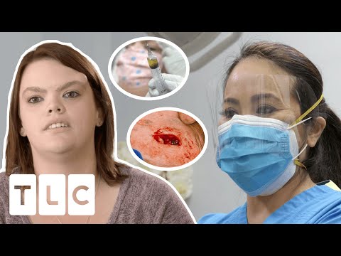 Dr. Lee Concerned Cyst Removal Surgery May Cause Brain Damage! I Dr Pimple Popper
