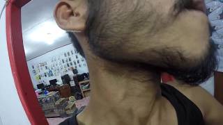 Brewok udah terlihat jelas setelah pakai minoxidil dan biotin