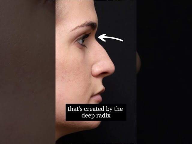 What is a Pseudo Hump?