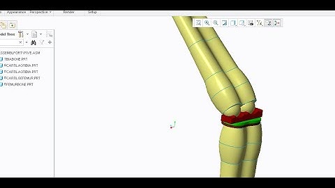 Finite element analysis of human knee joint to biomedical research in biomechanics simulation ABACUS