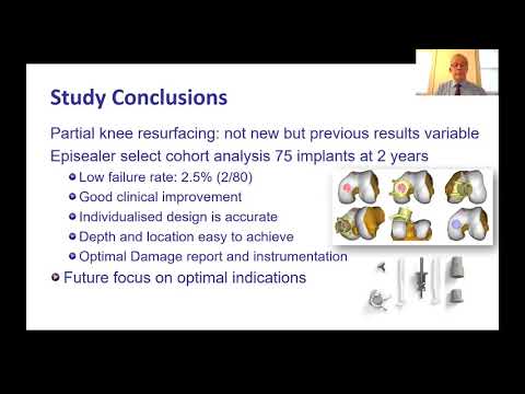 Episealer mini metal implant in the Knee and Ankle