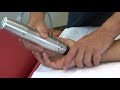 Thumb pain 1  zimmer medizinsystems enpuls treatment demo