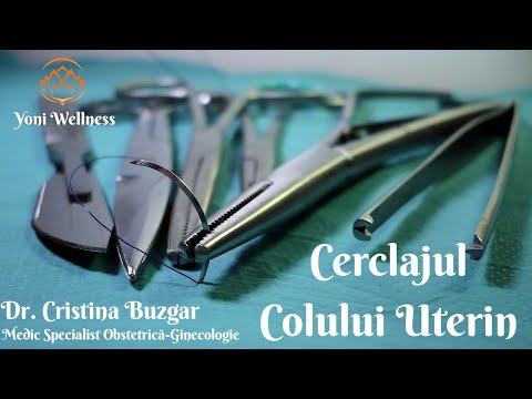 Video: Tratarea Colului Uterin (și Insuficienței Cervicale) La Sarcină