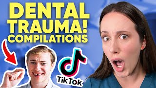 Knocked Out Permanent Tooth! Now What?