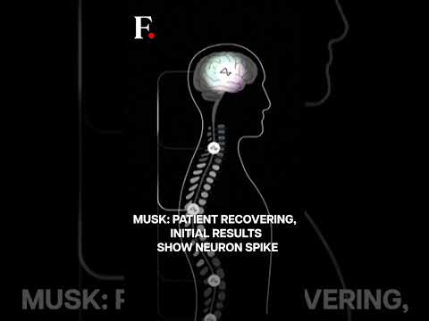 Musk's Neuralink Implants Brain Chip in First Human | Subscribe to Firstpost