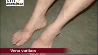 Punca-punca saluran darah tersumbat serta akibatnya.