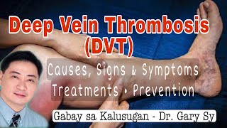 Deep Vein Thrombosis (DVT) - Dr. Gary Sy