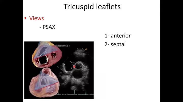 Right side valves - Dr. Heba Eldeeb