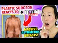 Plastic Surgeon Reacts to BOTCHED BY NATURE: Young Woman with Huge, Asymmetric Breasts